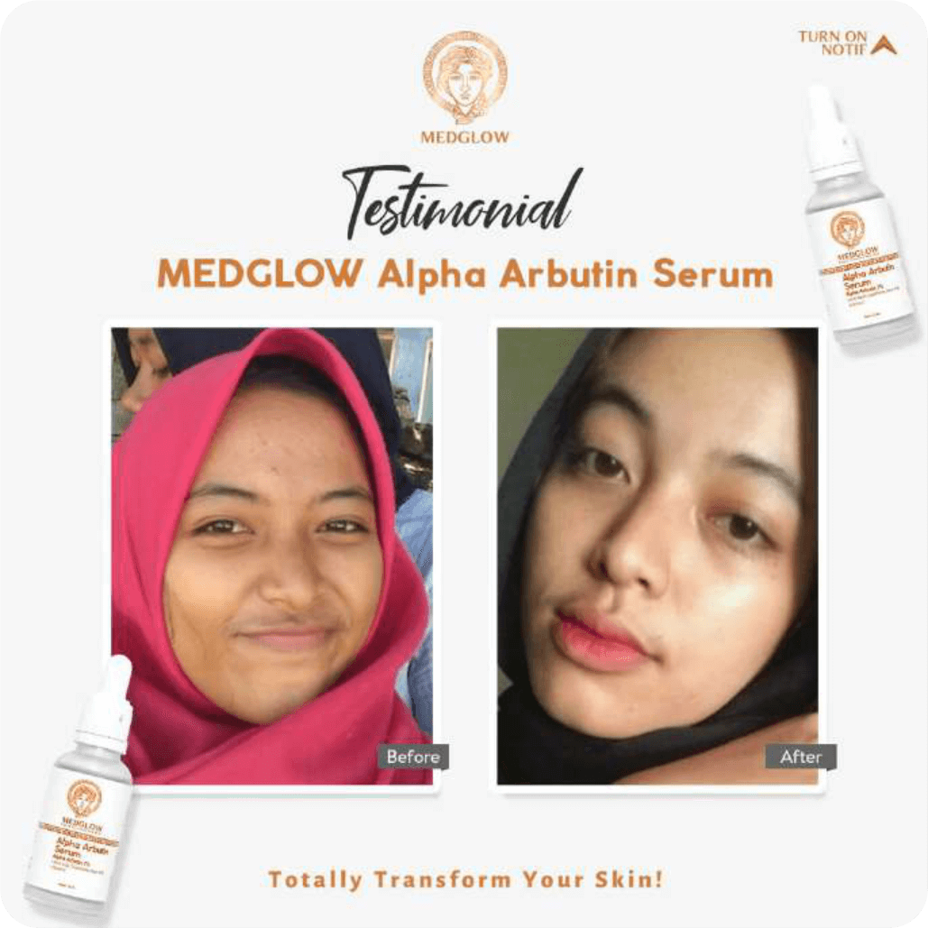 asset-medglow-testimoni-2.png