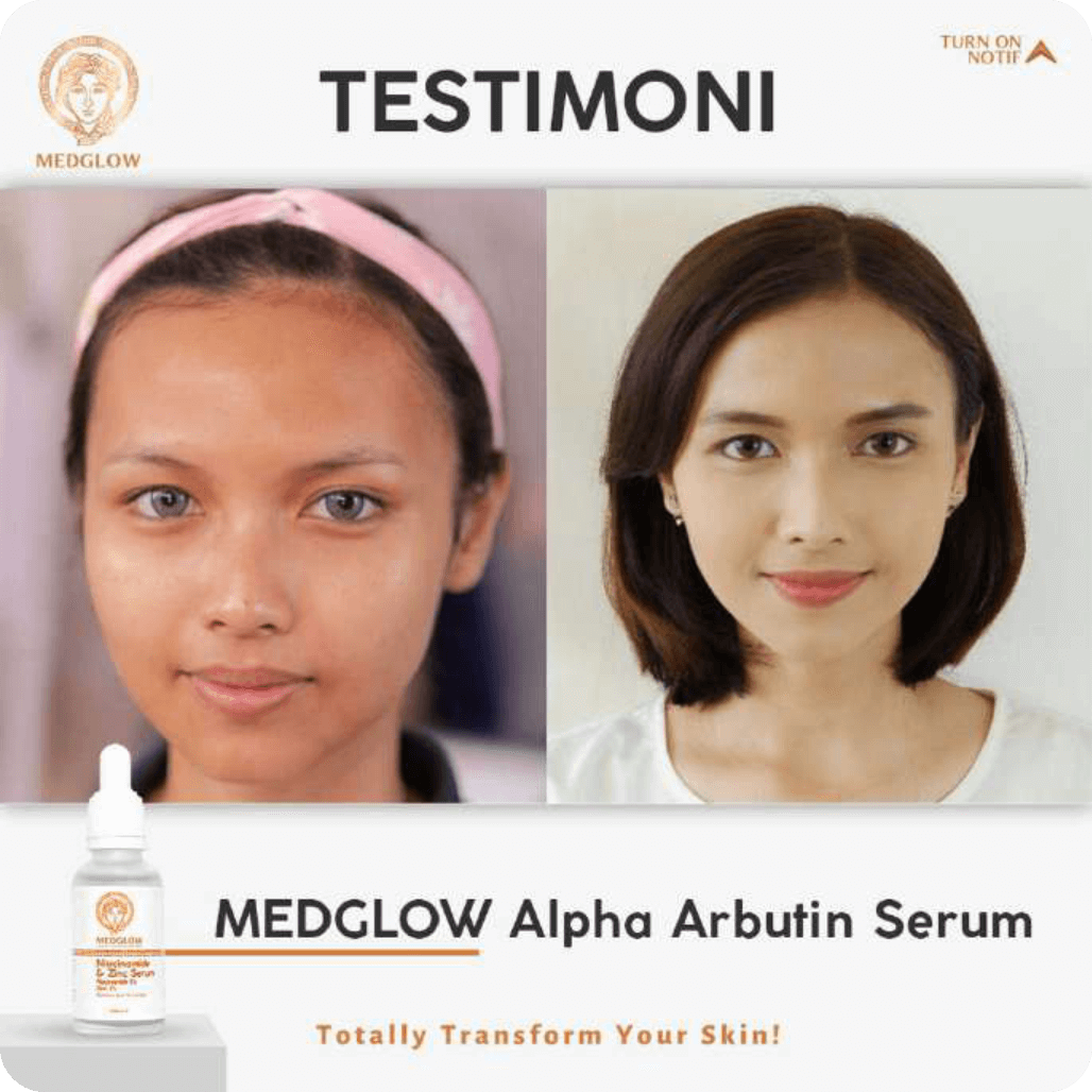 asset-medglow-testimoni-3.png