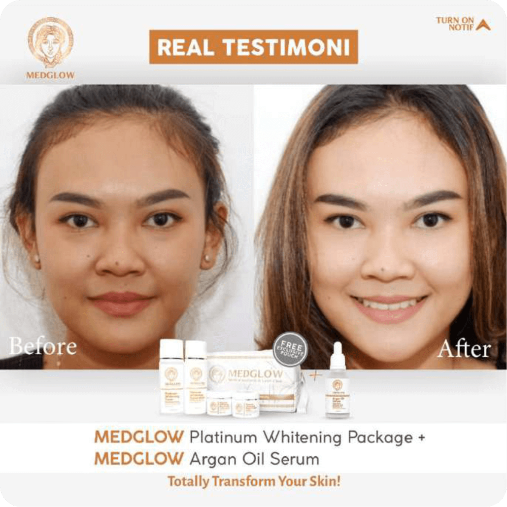 asset-medglow-testimoni-5.png